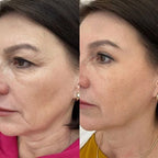 NYRA Anti-Aging Face Pillow